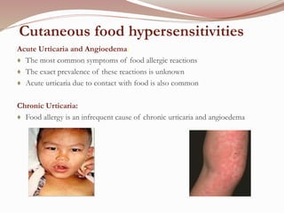 allergies due to food | PPTX