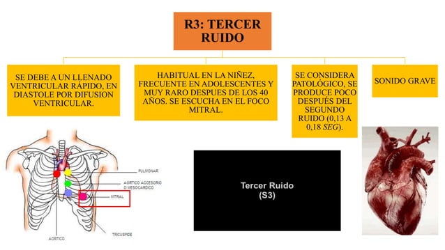 IRRIGACIÓN DEL RIÑON | PPTX