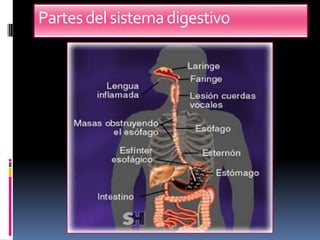 Partes del sistema digestivo
 