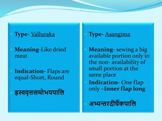  Type- Valluraka
 Meaning-Like dried
meat
 Indication- Flaps are
equal-Short, Round
 ह्रस्ववृत्तसमोभयपालल
 Type- Asangima
 Meaning- sewing a big
available portion only in
the non- availability of
small portion at the
same place
 Indication- One flap
only –Inner flap long
 अभ्यन्तरदीर्घैकपालल
 