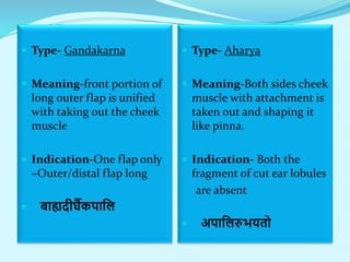  Type- Gandakarna
 Meaning-front portion of
long outer flap is unified
with taking out the cheek
muscle
 Indication-One flap only
–Outer/distal flap long
 बाह्यदीर्घैकपालल
 Type- Aharya
 Meaning-Both sides cheek
muscle with attachment is
taken out and shaping it
like pinna.
 Indication- Both the
fragment of cut ear lobules
are absent
 अपाललरुभयतो
 