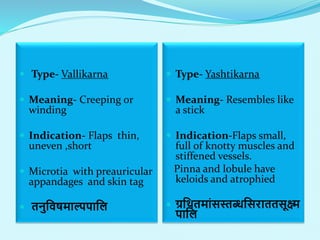  Type- Vallikarna
 Meaning- Creeping or
winding
 Indication- Flaps thin,
uneven ,short
 Microtia with preauricular
appandages and skin tag
 तनुलवषमाल्पपालल
 Type- Yashtikarna
 Meaning- Resembles like
a stick
 Indication-Flaps small,
full of knotty muscles and
stiffened vessels.
Pinna and lobule have
keloids and atrophied
 ग्रलथतमाांसस्तब्धलसराततसूक्ष्म
पालल
 