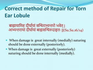 Correct method of Repair for Torn
Ear Lobule
बाह्यायानिह दीर्ाणयां सन्धन्धराभ्यन्तरो भिेत् |
आभ्यन्तरायां दीर्ाणयां बाह्यसन्धघर्रुदाहृताः ||(Su.Su.16/14)
 When damage is great internally (medially) suturing
should be done externally (posteriorly).
 When damage is great externally (posteriorly)
suturing should be done internally (medially).
 