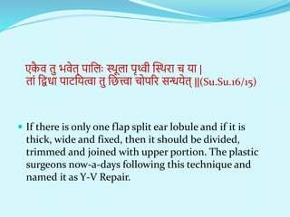 एक
ै ि तु भिेत् पानलाः स्थूला पृथ्वी न्धस्थरा च या |
तां नििा पाटनयत्वा तु नित्त्वा चोपरर सन्धयेत् ||(Su.Su.16/15)
 If there is only one flap split ear lobule and if it is
thick, wide and fixed, then it should be divided,
trimmed and joined with upper portion. The plastic
surgeons now-a-days following this technique and
named it as Y-V Repair.
 