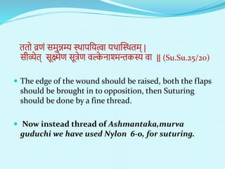 ततो व्रणं सिुन्नम्य स्थापनयत्वा यथान्धस्थति् |
सीर्व्ेत् सूक्ष्मेण सूत्रेण िल्क
े िाश्मन्तकस्य िा || (Su.Su.25/20)
 The edge of the wound should be raised, both the flaps
should be brought in to opposition, then Suturing
should be done by a fine thread.
 Now instead thread of Ashmantaka,murva
guduchi we have used Nylon 6-0, for suturing.
 