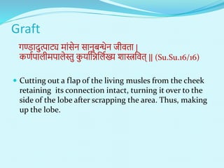 Graft
गण्डादुत्पाट्य िांसेि सािुबन्धेि िीिता |
कणणपालीिपालेस्तु क
ु याणनन्ननलणख्य शास्त्रनित् || (Su.Su.16/16)
 Cutting out a flap of the living musles from the cheek
retaining its connection intact, turning it over to the
side of the lobe after scrapping the area. Thus, making
up the lobe.
 