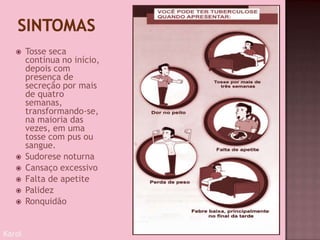  Tosse seca
contínua no início,
depois com
presença de
secreção por mais
de quatro
semanas,
transformando-se,
na maioria das
vezes, em uma
tosse com pus ou
sangue.
 Sudorese noturna
 Cansaço excessivo
 Falta de apetite
 Palidez
 Ronquidão
Karol
 