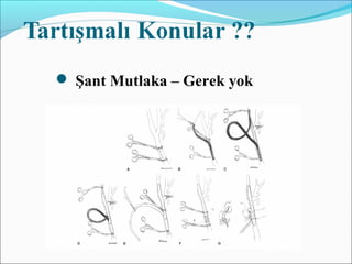  Şant Mutlaka – Gerek yok
 