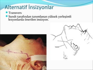 Alternatif İnsizyonlar
Transvers
Sundt tarafından tanımlanan yüksek yerleşimli
lezyonlarda önerilen insizyon.
 