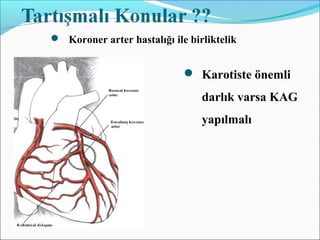  Koroner arter hastalığı ile birliktelik
 Karotiste önemli
darlık varsa KAG
yapılmalı
 