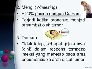 2. Mengi (Wheezing)
• ± 20% pasien dengan Ca Paru
• Terjadi ketika bronchus menjadi
tersumbat oleh tumor
3. Demam
• Tidak tetap, sebagai gejala awal
(dini) dalam respons terhadap
infeksi yang menetap pada area
pneumonitis ke arah distal tumor
 