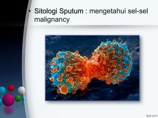 • Sitologi Sputum : mengetahui sel-sel
malignancy
 