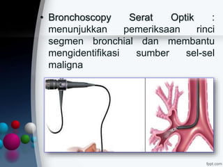 • Bronchoscopy Serat Optik :
menunjukkan pemeriksaan rinci
segmen bronchial dan membantu
mengidentifikasi sumber sel-sel
maligna
 