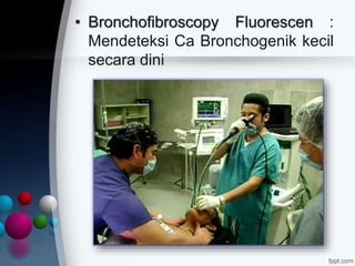 • Bronchofibroscopy Fluorescen :
Mendeteksi Ca Bronchogenik kecil
secara dini
 