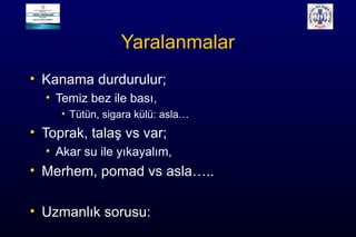 Yaralanmalar
• Kanama durdurulur;
• Temiz bez ile bası,
• Tütün, sigara külü: asla…
• Toprak, talaş vs var;
• Akar su ile yıkayalım,
• Merhem, pomad vs asla…..
• Uzmanlık sorusu:
 