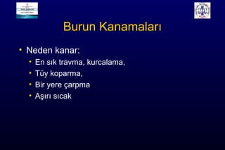 Burun Kanamaları
• Neden kanar:
• En sık travma, kurcalama,
• Tüy koparma,
• Bir yere çarpma
• Aşırı sıcak
 