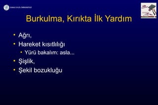 Burkulma, Kırıkta İlk Yardım
• Ağrı,
• Hareket kısıtlılığı
• Yürü bakalım: asla...
• Şişlik,
• Şekil bozukluğu
 