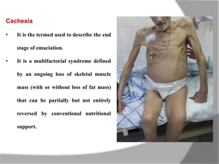 Cachexia
• It is the termed used to describe the end
stage of emaciation.
• It is a multifactorial syndrome defined
by an ongoing loss of skeletal muscle
mass (with or without loss of fat mass)
that can be partially but not entirely
reversed by conventional nutritional
support.
 