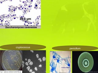 cont
cryptococcus penicillum
 