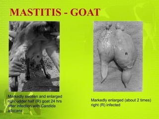 MASTITIS - GOAT
Markedly enlarged (about 2 times)
right (R) infected
Markedly swollen and enlarged
right udder half (R) goat 24 hrs
after infection with Candida
albicans.
 
