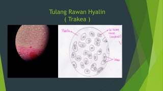 Tulang Rawan Hyalin
( Trakea )
 