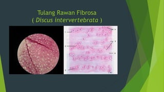 Tulang Rawan Fibrosa
( Discus intervertebrata )
 