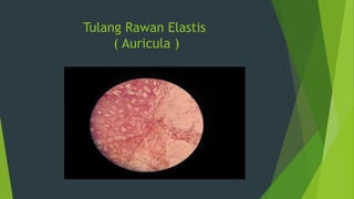 Tulang Rawan Elastis
( Auricula )
 