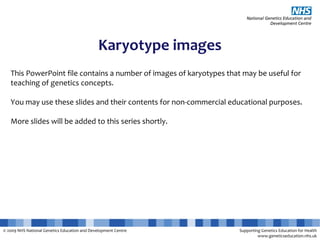 © 2009 NHS National Genetics Education and Development Centre Supporting Genetics Education for Health
www.geneticseducation.nhs.uk
Karyotype images
This PowerPoint file contains a number of images of karyotypes that may be useful for
teaching of genetics concepts.
You may use these slides and their contents for non-commercial educational purposes.
More slides will be added to this series shortly.
 