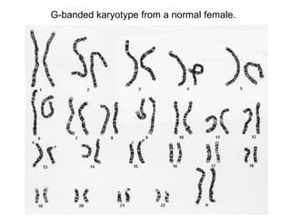 G-banded karyotype from a normal female. 
