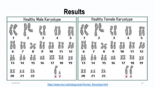 6/18/2017 14
Results
https://www.mun.ca/biology/scarr/Human_Karyotype.html
 