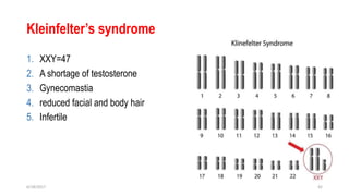 Kleinfelter’s syndrome
1. XXY=47
2. A shortage of testosterone
3. Gynecomastia
4. reduced facial and body hair
5. Infertile
6/18/2017 42
 