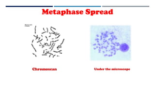 Metaphase Spread
Under the microscopeChromoscan
 