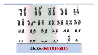 46,xy,del (5)(q31)
 