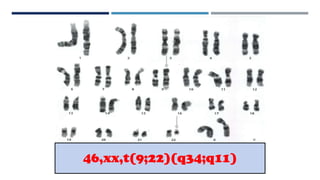 46,xx,t(9;22)(q34;q11)
 