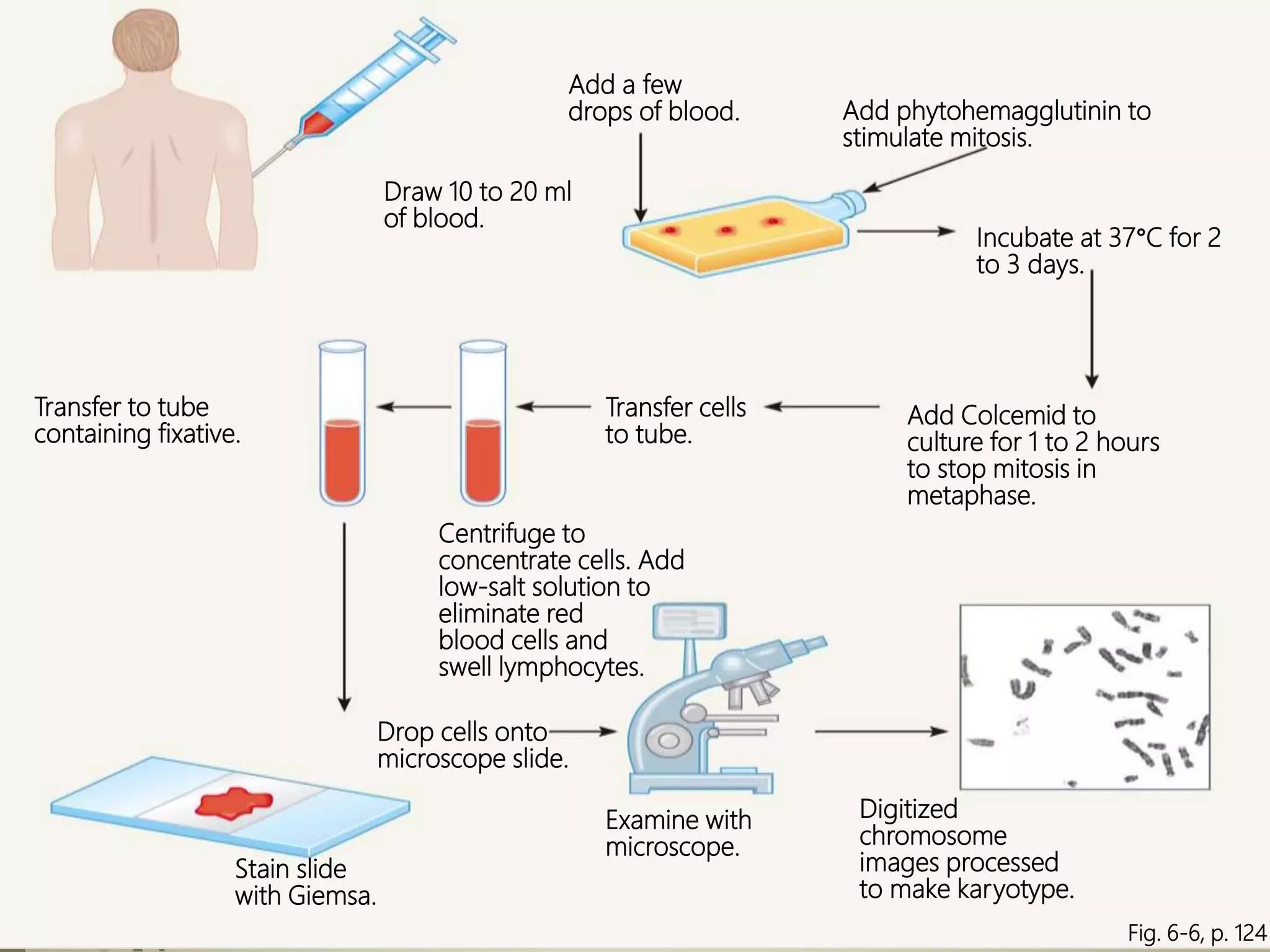 Fig. 6-6, p. 124
Add a few
drops of blood. Add phytohemagglutinin to
stimulate mitosis.
Draw 10 to 20 ml
of blood.
Incubate at 37°C for 2
to 3 days.
Transfer to tube
containing fixative.
Transfer cells
to tube.
Add Colcemid to
culture for 1 to 2 hours
to stop mitosis in
metaphase.
Centrifuge to
concentrate cells. Add
low-salt solution to
eliminate red
blood cells and
swell lymphocytes.
Drop cells onto
microscope slide.
Examine with
microscope.
Digitized
chromosome
images processed
to make karyotype.
Stain slide
with Giemsa.
 