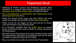 • Ankhyan & Weber (2001) and Sankhyan (2008): They
assumed it a surgical intervention and classifying the 11
attempts made in three major stages at different times.
• He re-classified the 11 perforations into: depressions (1-5)
and trepanned holes (6-11.
• Holes are almost of the same size and outline and were
made very neatly and carefully by the same instrument.
• Holes (10 & 11), are bigger in size and uneven in shape,
were most likely a post-mortem study
• It is therefore possible that the antler piece or animal
bones could have been used as drills of various diameters
for trepanation.
• She had to bear the torture of so many strokes on her vault
for trepanations, obviously for treatment and not for bone
roundels as argued by Basu & Pal (1980).
• But, every likely she could not survive the 9th operation
Trepanned Skull
 