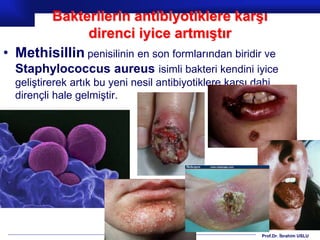 Prof.Dr. İbrahim USLU
Bakterilerin antibiyotiklere karşı
direnci iyice artmıştır
• Methisillin penisilinin en son formlarından biridir ve
Staphylococcus aureus isimli bakteri kendini iyice
geliştirerek artık bu yeni nesil antibiyotiklere karşı dahi
dirençli hale gelmiştir.
 