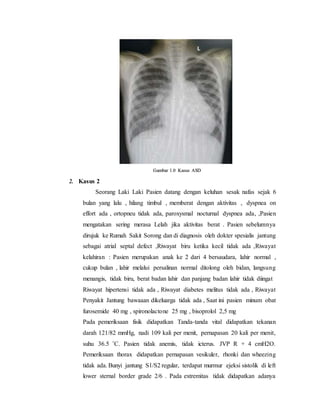 2. Kasus 2
Seorang Laki Laki Pasien datang dengan keluhan sesak nafas sejak 6
bulan yang lalu , hilang timbul , memberat dengan aktivitas , dyspnea on
effort ada , ortopneu tidak ada, paroxysmal nocturnal dyspnea ada, ,Pasien
mengatakan sering merasa Lelah jika aktivitas berat . Pasien sebelumnya
dirujuk ke Rumah Sakit Sorong dan di diagnosis oleh dokter spesialis jantung
sebagai atrial septal defect ,Riwayat biru ketika kecil tidak ada ,Riwayat
kelahiran : Pasien merupakan anak ke 2 dari 4 bersaudara, lahir normal ,
cukup bulan , lahir melalui persalinan normal ditolong oleh bidan, langsung
menangis, tidak biru, berat badan lahir dan panjang badan lahir tidak diingat
Riwayat hipertensi tidak ada , Riwayat diabetes melitus tidak ada , Riwayat
Penyakit Jantung bawaaan dikeluarga tidak ada , Saat ini pasien minum obat
furosemide 40 mg , spironolactone 25 mg , bisoprolol 2,5 mg
Pada pemeriksaan fisik didapatkan Tanda-tanda vital didapatkan tekanan
darah 121/82 mmHg, nadi 109 kali per menit, pernapasan 20 kali per menit,
suhu 36.5 ˚C. Pasien tidak anemis, tidak icterus. JVP R + 4 cmH2O.
Pemeriksaan thorax didapatkan pernapasan vesikuler, rhonki dan wheezing
tidak ada. Bunyi jantung S1/S2 regular, terdapat murmur ejeksi sistolik di left
lower sternal border grade 2/6 . Pada extremitas tidak didapatkan adanya
Gambar 1.0 Kasus ASD
 
