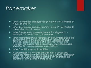 Pacing Letters Cardiac Arrhythmias | PPT