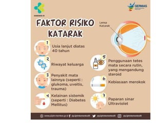 Katarak