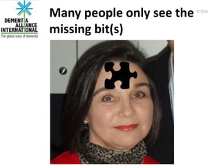 Many people only see the
missing bit(s)