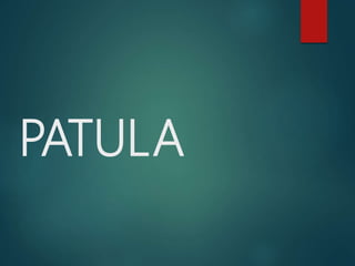 PATULA
 