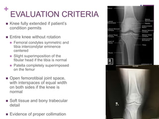 +
EVALUATION CRITERIA
 Knee fully extended if patient’s
condition permits
 Entire knee without rotation
 Femoral condyles symmetric and
tibia intercondylar eminence
centered
 Slight superimposition of the
fibular head if the tibia is normal
 Patella completely superimposed
on the femur
 Open femorotibial joint space,
with interspaces of equal width
on both sides if the knee is
normal
 Soft tissue and bony trabecular
detail
 Evidence of proper collimation
 