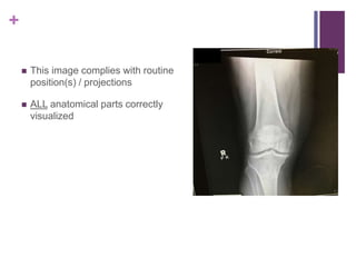+
 This image complies with routine
position(s) / projections
 ALL anatomical parts correctly
visualized
 
