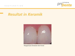 Kaufunktion - proDente