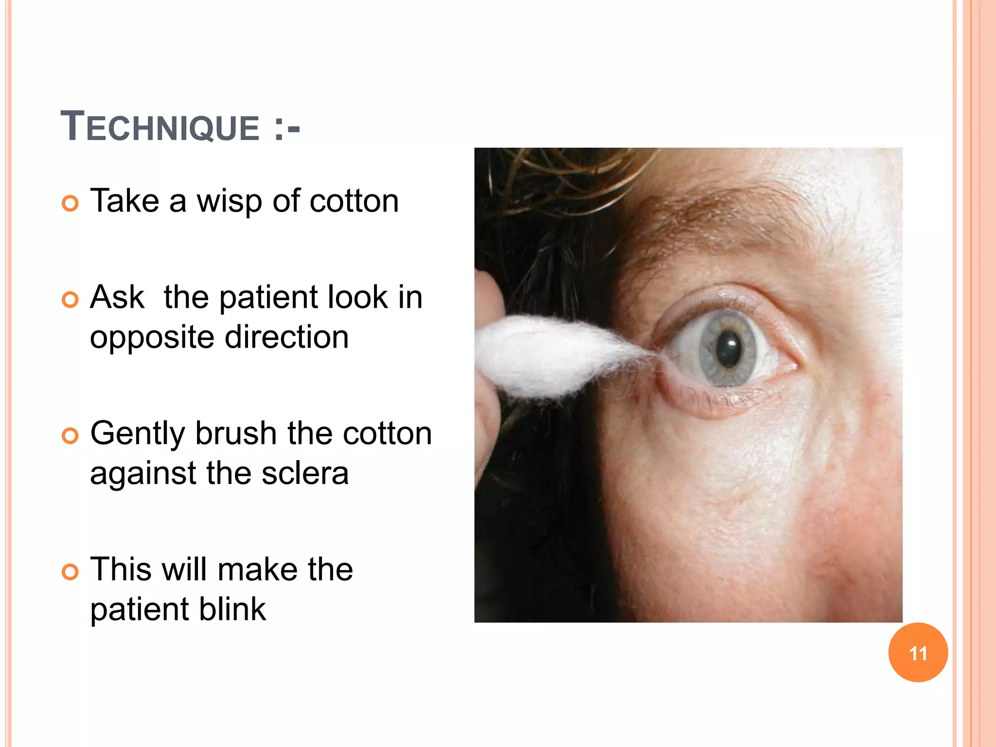 TECHNIQUE :-
 Take a wisp of cotton
 Ask the patient look in
opposite direction
 Gently brush the cotton
against the sclera
 This will make the
patient blink
11
 