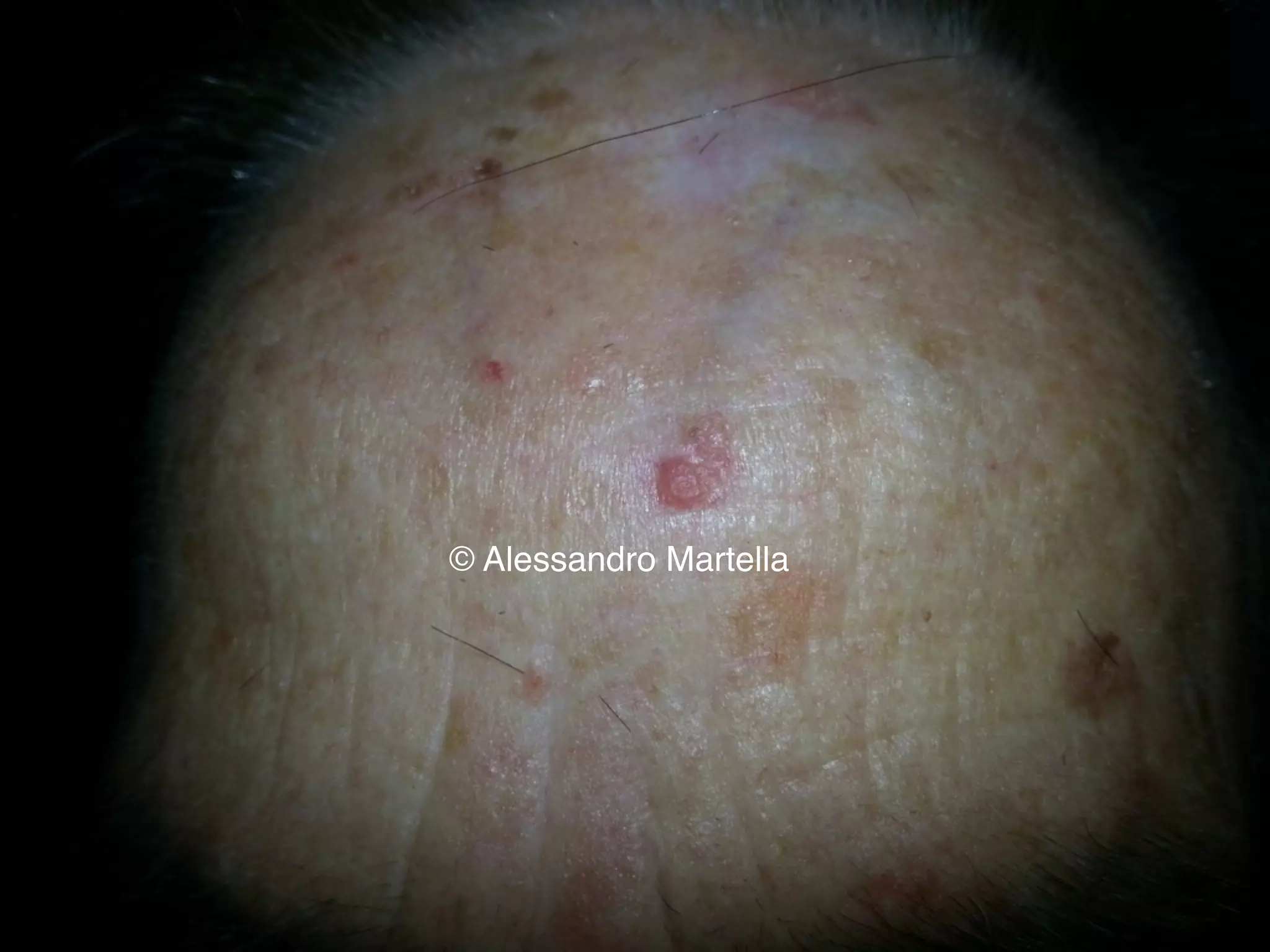 © Alessandro Martella
 