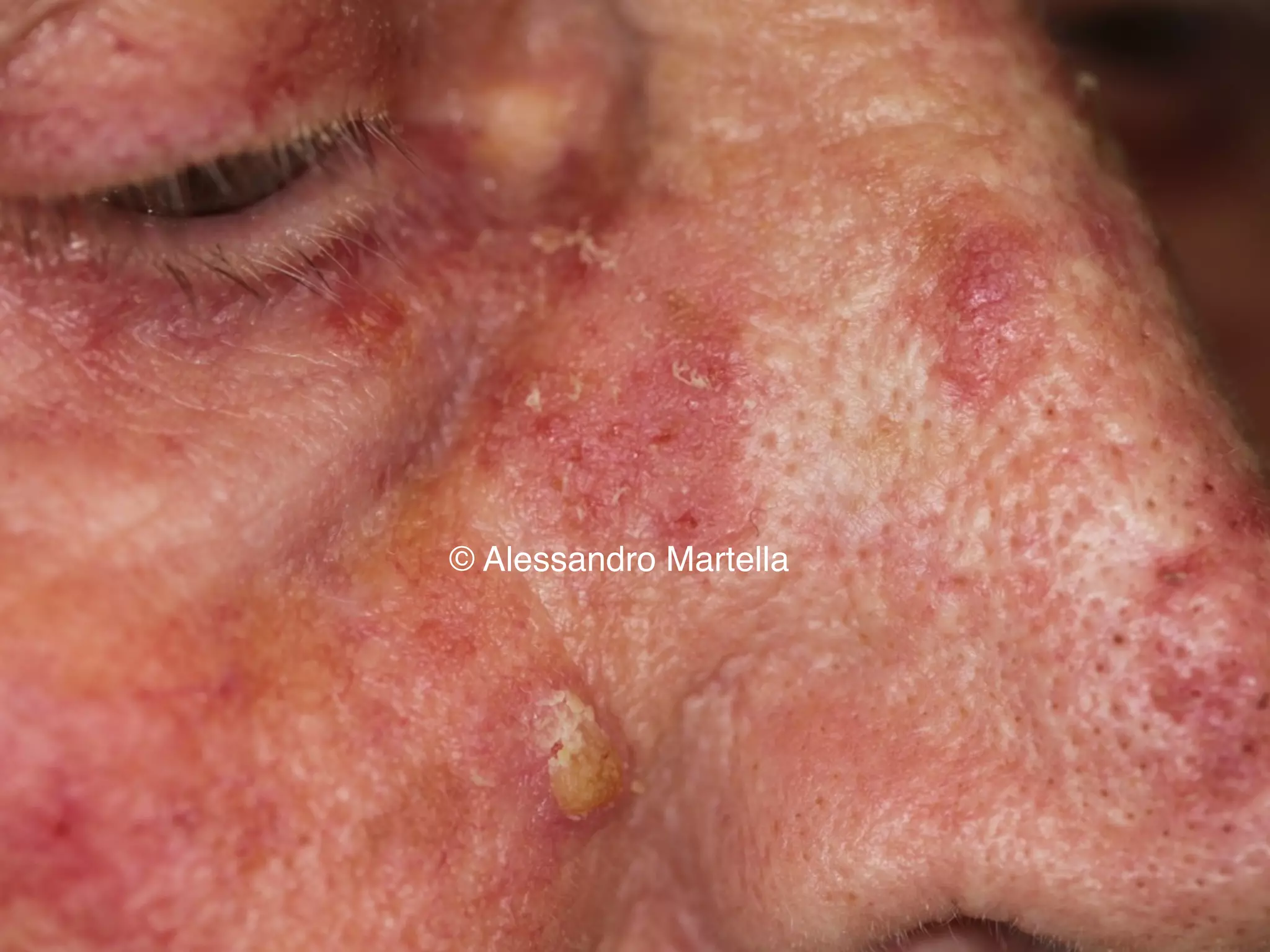 © Alessandro Martella
 