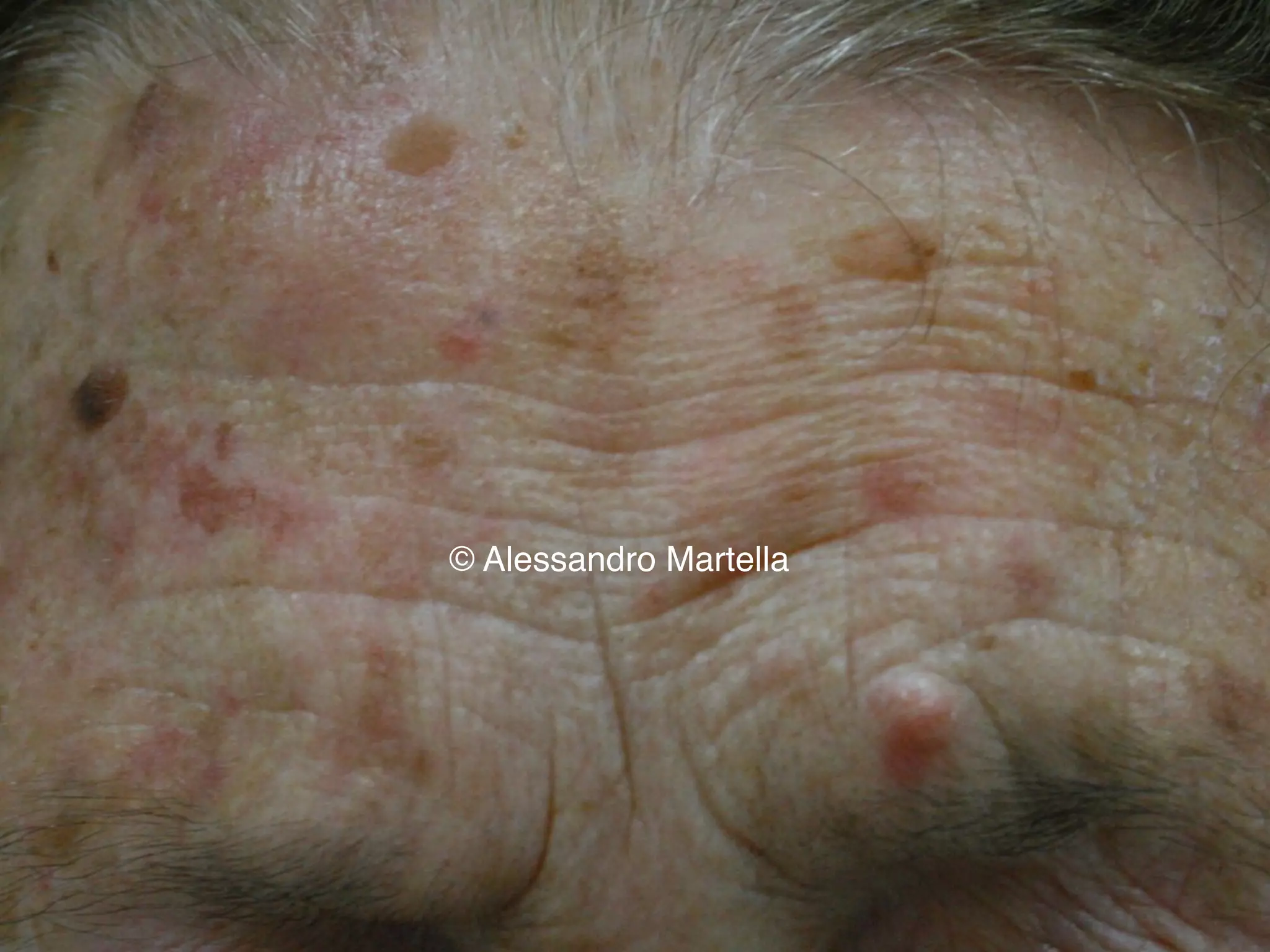 © Alessandro Martella
 