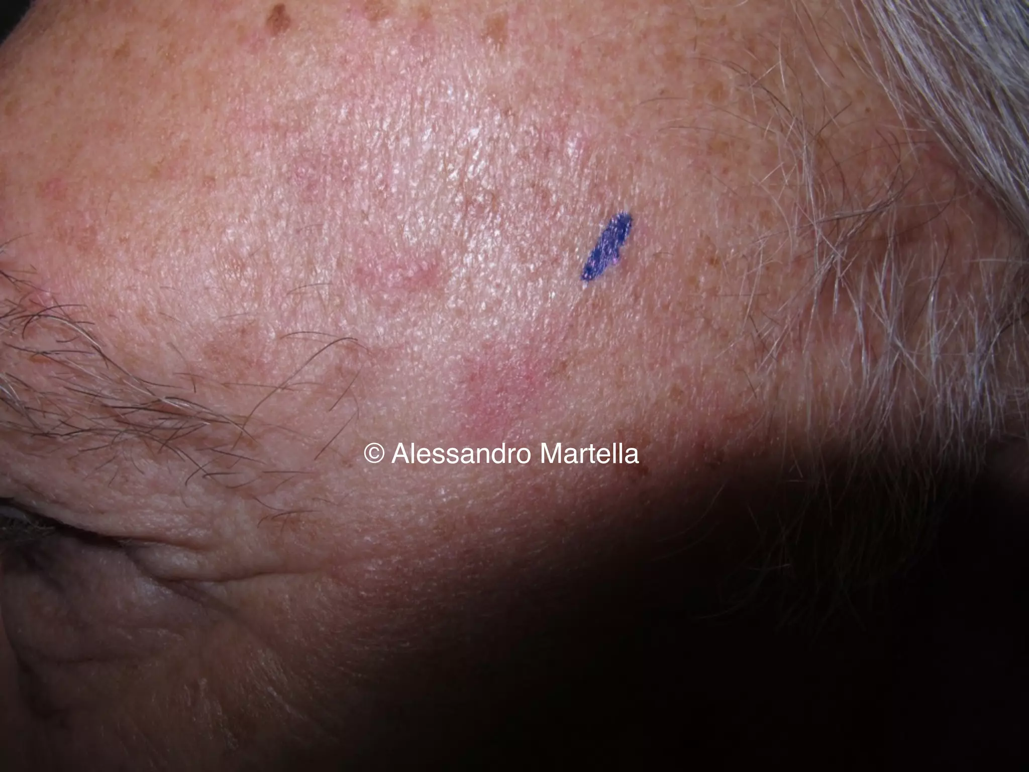 © Alessandro Martella
 